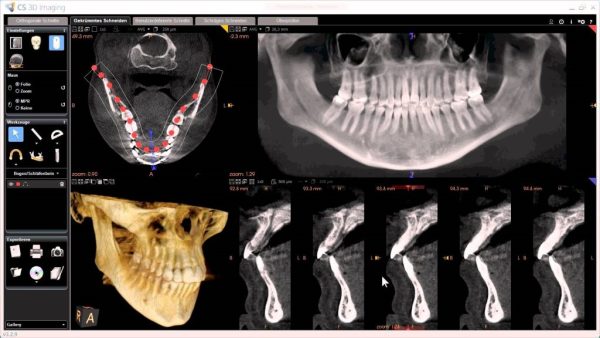 Cbct Cone Beam Computed